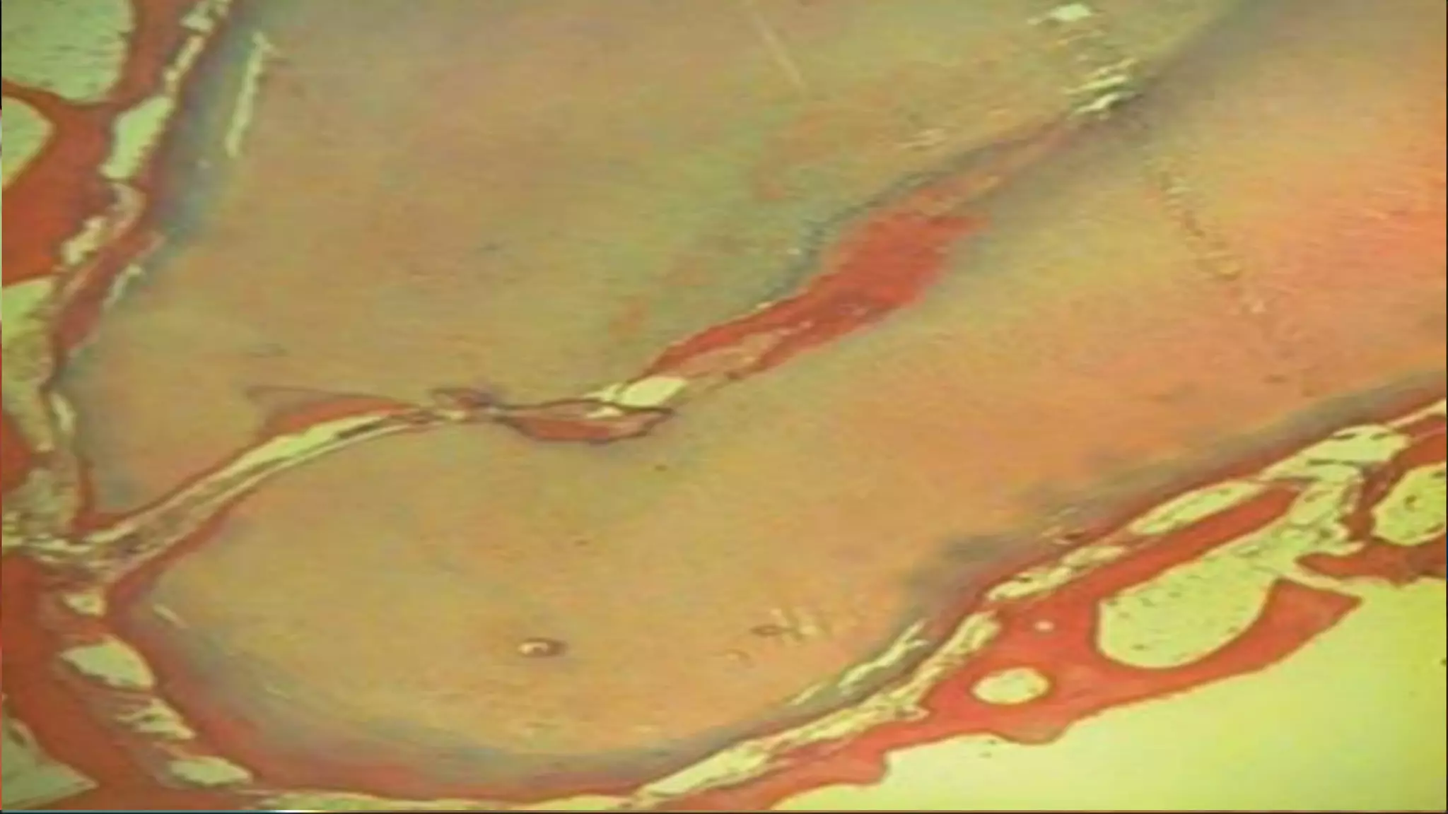 SEVERAL
CONSTRICTIONS
 