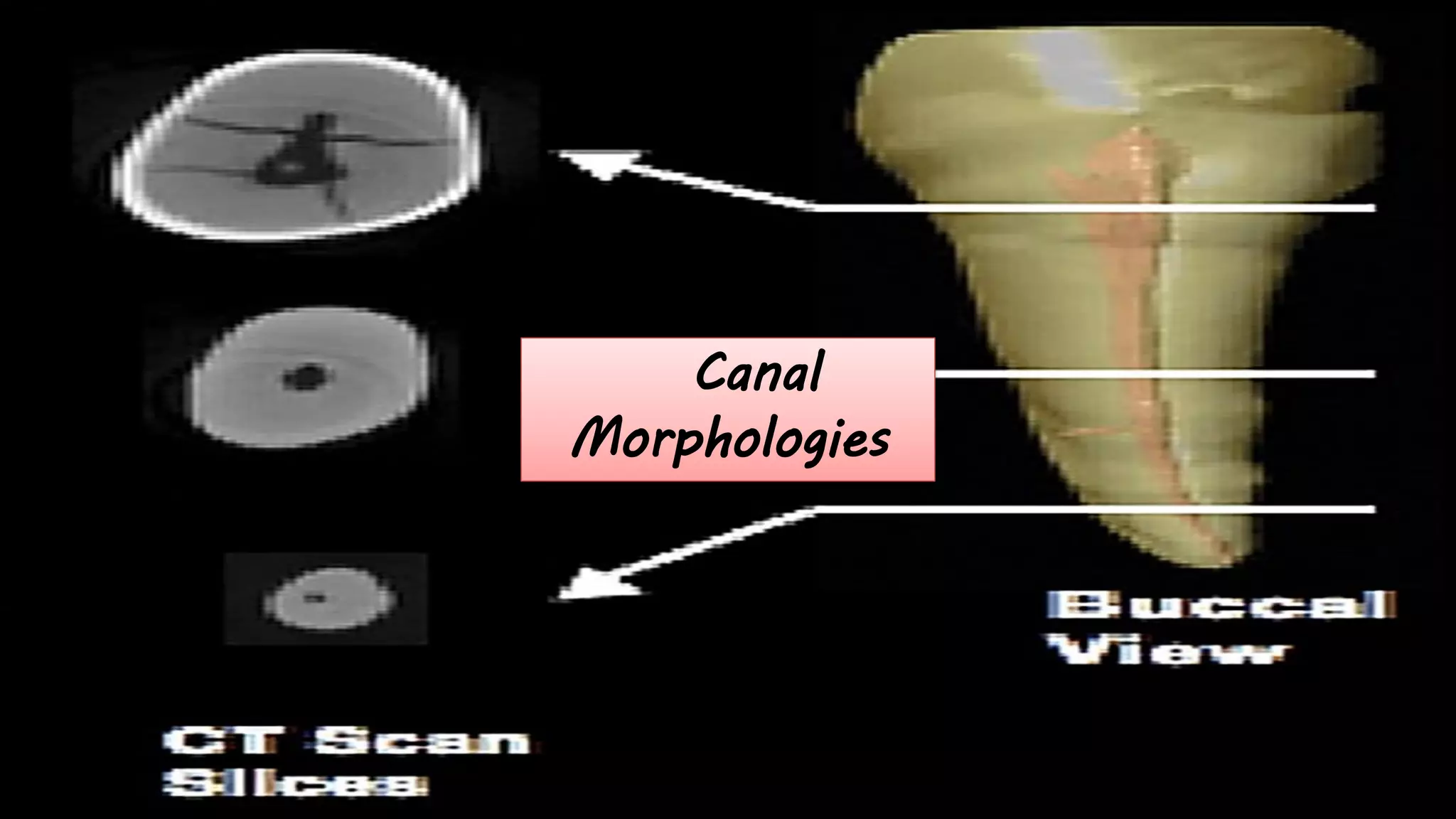 Canal
Morphologies
 