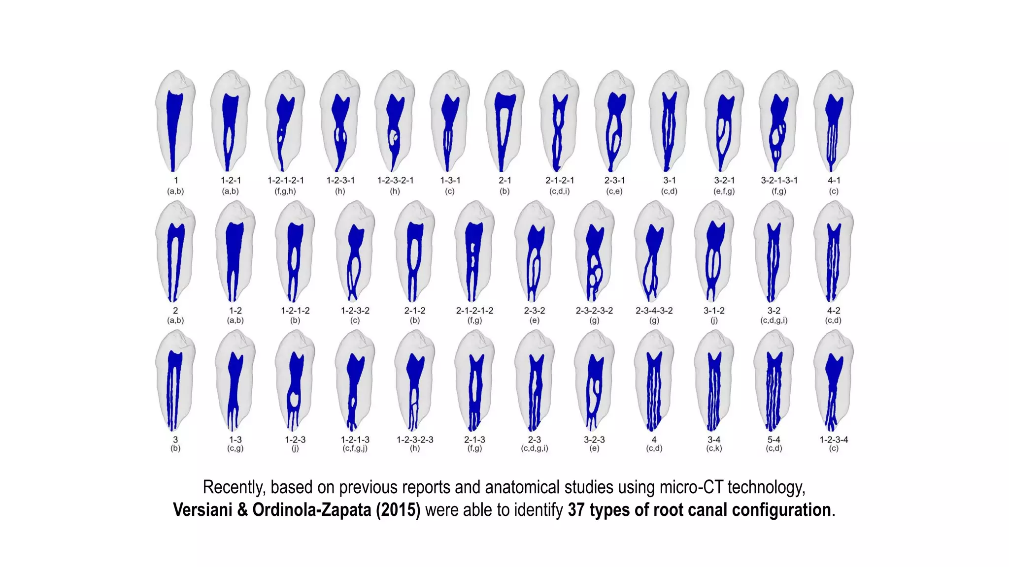 Introduction
AhmedHMA, VersianiMA, De-Deus G, Dummer PMH. A new system for classifying root and root canal morphology. International Endodontic Journal 2016
Recently, based on previous reports and anatomical studies using micro-CT technology,
Versiani & Ordinola-Zapata (2015) were able to identify 37 types of root canal configuration.
 