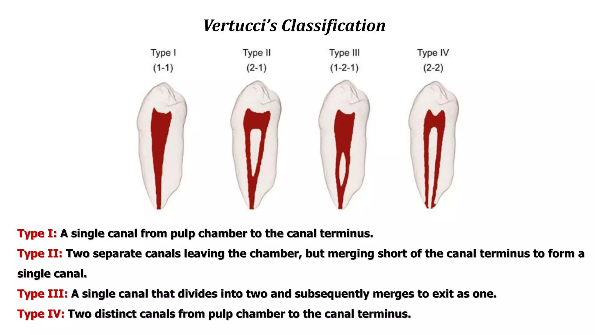 Vertucci’s Classification
Type I: A single canal from pulp chamber to the canal terminus.
Type II: Two separate canals leaving the chamber, but merging short of the canal terminus to form a
single canal.
Type III: A single canal that divides into two and subsequently merges to exit as one.
Type IV: Two distinct canals from pulp chamber to the canal terminus.
 