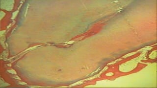 SEVERAL
CONSTRICTIONS
 