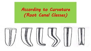 According to Curvature
(Root Canal Classes)
 