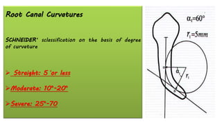 Root Canal Curvatures
SCHNEIDER‘ sclassification on the basis of degree
of curvature
➢ Straight: 5 ̊or less
➢Moderate: 10°-20°
➢Severe: 25°-70
 