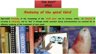 Appreciable knowledge of the morphology of this ‘small zone’ and its variance, ability to interpret it
correctly in radiograph, and to ‘feel’ it through tactile sensation during instrumentation are essential for an
effective rendering of the treatment of root canals.
THE ROOT
APEX
Anatomy of the apical third
 