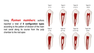 Introduction
Using Roman numbers, authors
reported a total of 8 configuration types
according to the pattern of division of the main
root canal along its course from the pulp
chamber to the root apex
 