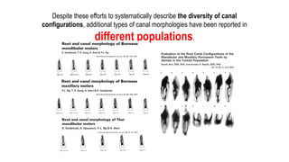 Introduction
Despite these efforts to systematically describe the diversity of canal
configurations, additional types of canal morphologies have been reported in
different populations.
 