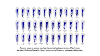 Introduction
AhmedHMA, VersianiMA, De-Deus G, Dummer PMH. A new system for classifying root and root canal morphology. International Endodontic Journal 2016
Recently, based on previous reports and anatomical studies using micro-CT technology,
Versiani & Ordinola-Zapata (2015) were able to identify 37 types of root canal configuration.
 