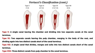 Vertucci’s Classification (cont.)
Type V: A single canal leaving the chamber and dividing into two separate canals at the canal
terminus.
Type VI: Two separate canals leaving the pulp chamber, merging in the body of the root, and
dividing again into two distinct canals short of the canal terminus.
Type VII: A single canal that divides, merges and exits into two distinct canals short of the canal
terminus.
Type VIII: Three distinct canals from pulp chamber to the canal terminus.
 