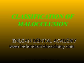 CLASSIFICATION OF
  MALOCCLUSION

 INDIAN DENTAL ACADEMY
www.indiandentalacademy.com

      www.indiandentalacademy.co
 