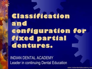 Classification
and
configuration for
fixed partial
dentures.
INDIAN DENTAL ACADEMY
Leader in continuing Dental Education
www.indiandentalacademy.com
 