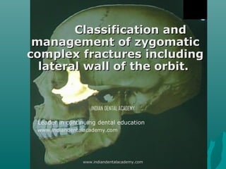 Classification and
management of zygomatic
complex fractures including
lateral wall of the orbit.

INDIAN DENTAL ACADEMY
Leader in continuing dental education
www.indiandentalacademy.com

www.indiandentalacademy.com

 