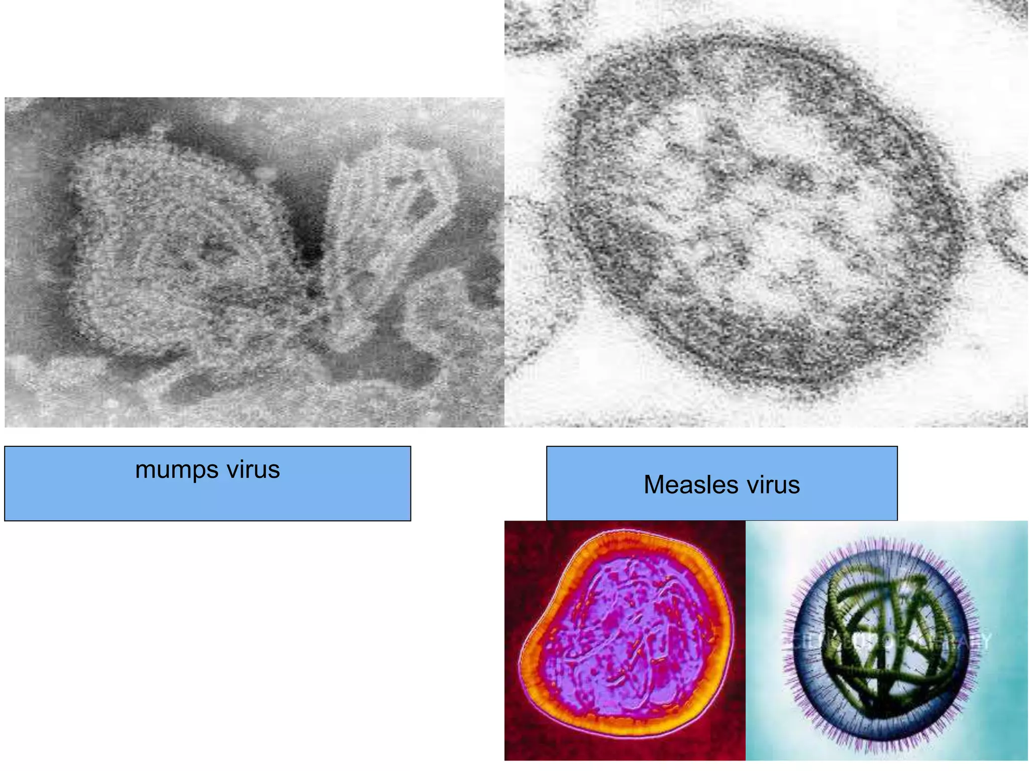 mumps virus
Measles virus
 