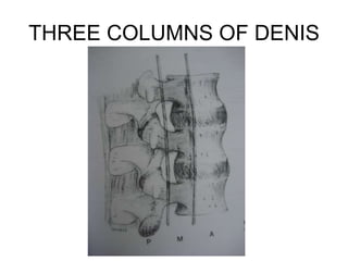 THREE COLUMNS OF DENIS
 