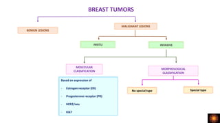 BREAST TUMORS
BENIGN LESIONS
MALIGNANT LESIONS
INSITU INVASIVE
MOLECULAR
CLASSIFICATION
MORPHOLOGICAL
CLASSIFICATION
Based on expression of
- Estrogen receptor (ER)
- Progesterone receptor (PR)
- HER2/neu
- Ki67
No special type Special type
 