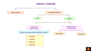 BREAST TUMORS
BENIGN LESIONS MALIGNANT LESIONS
MOLECULAR
CLASSIFICATION
MORPHOLOGICAL
CLASSIFICATION
Based on expression of ER,PR, HER2/neu and Ki67
• Luminal A
• Luminal B
• HER2 rich
• Basal type
No special type Special type
INSITU INVASIVE
 