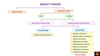 BREAST TUMORS
BENIGN LESIONS
MALIGNANT LESIONS
INVASIVE
MOLECULAR CLASSIFICATION MORPHOLOGICAL CLASSIFICATION
No special type Special type
Invasive ductal carcinoma
• Papillary carcinoma
• Invasive lobular carcinoma
• Tubular carcinoma
• Medullary carcinoma
• Inflammatory carcinoma
• Mucinous carcinoma
• Metaplastic carcinoma
• Cribriform carcinoma
INSITU
Paint me In MMC
 