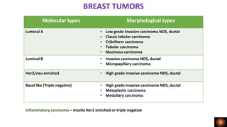 BREAST TUMORS
Molecular types Morphological types
Luminal A • Low grade Invasive carcinoma NOS, ductal
• Classic lobular carcinoma
• Cribriform carcinoma
• Tubular carcinoma
• Mucinous carcinoma
Luminal B • Invasive carcinoma NOS, ductal
• Micropapillary carcinoma
Her2/neu enriched • High grade invasive carcinoma NOS, ductal
Basal like (Triple negative) • High grade invasive carcinoma NOS, ductal
• Metaplastic carcinoma
• Medullary carcinoma
Inflammatory carcinoma – mostly Her2 enriched or triple negative
 