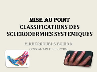 MISE AU POINT
CLASSIFICATIONS DES
SCLERODERMIES SYSTEMIQUES
M.KHERROUBI-S.BOUIBA
CCSSSM/Ain Turck/2°RM
1
 