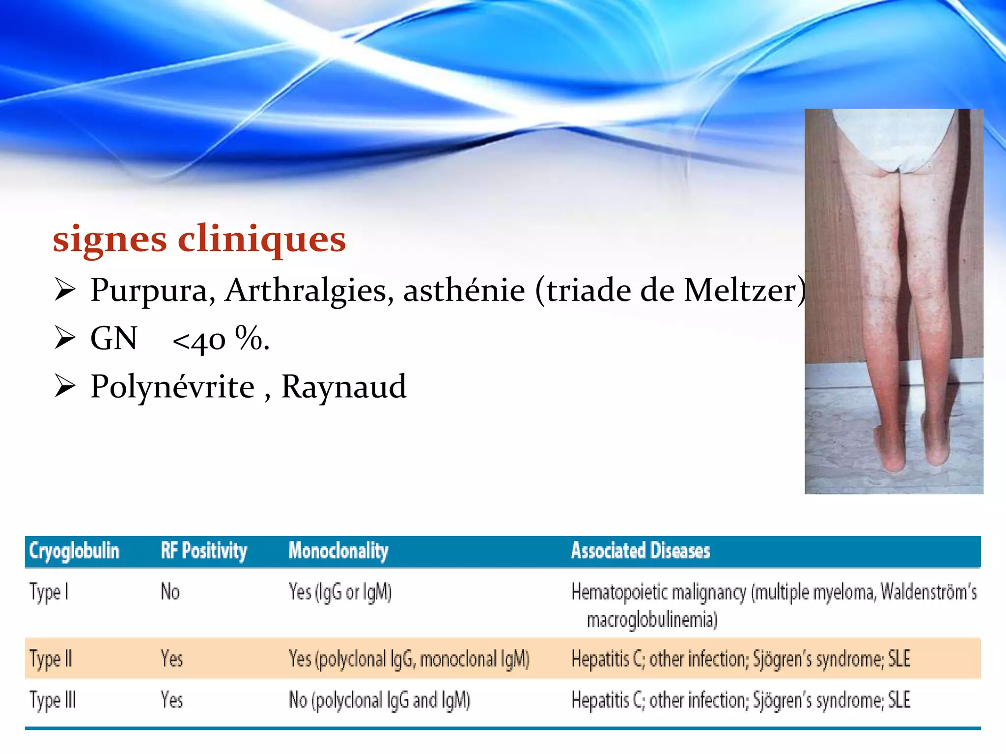 Classification of vasculitis