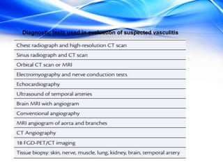 Diagnostic tests used in evaluation of suspected vasculitis
 