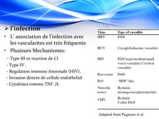  l’infection
• L’ association de l’infection avec
les vascularites est trés fréquente
• Plusieurs Mechanismes:
- Type III or reaction de CI
- Type IV ,
- Regulation immune Anormale (HIV),
- Invasion directe de cellule endothelial
- Cytokines comme TNF ,IL
Adapted from Pagnoux et al
 