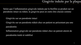 Selon que l’inflammation gingivale induite par le biofilm se produit sur un
parodonte intact ou réduit, la gingivite peut en outre être classée comme
Gingivite induite par la plaque
Gingivite sur un parodonte intact
Gingivite sur un parodonte réduit chez un patient ne présentant pas une
parodontite
Inflammation gingivale sur parodonte réduit chez un patient atteint de
parodontite traité et stabilisé
84
 