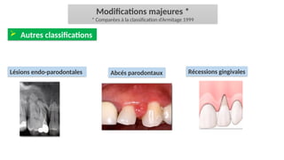 Classification des maladies parodontales | PPSX