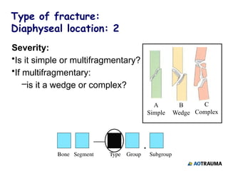 classification of fractures&$&$$$)$.pptx