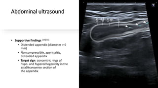 Abdominal ultrasound
• Supportive findings [10][31]
• Distended appendix (diameter > 6
mm)
• Noncompressible, aperistaltic,
distended appendix
• Target sign: concentric rings of
hypo- and hyperechogenicity in the
axial/transverse section of
the appendix
 