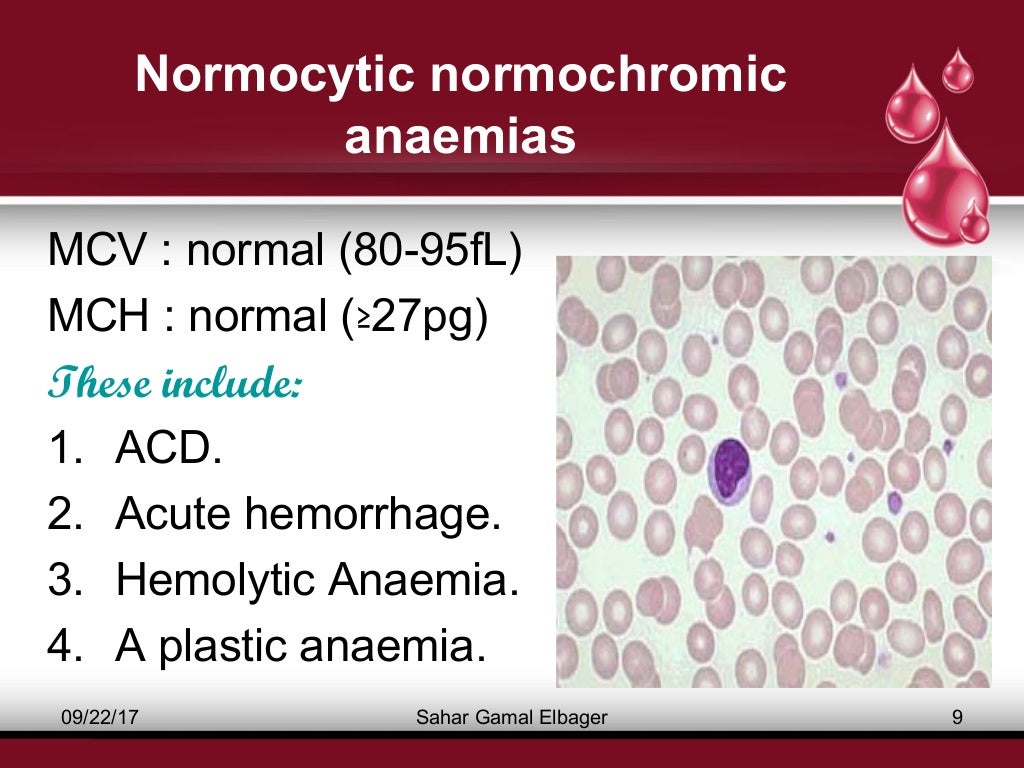 Classification of anaemia
