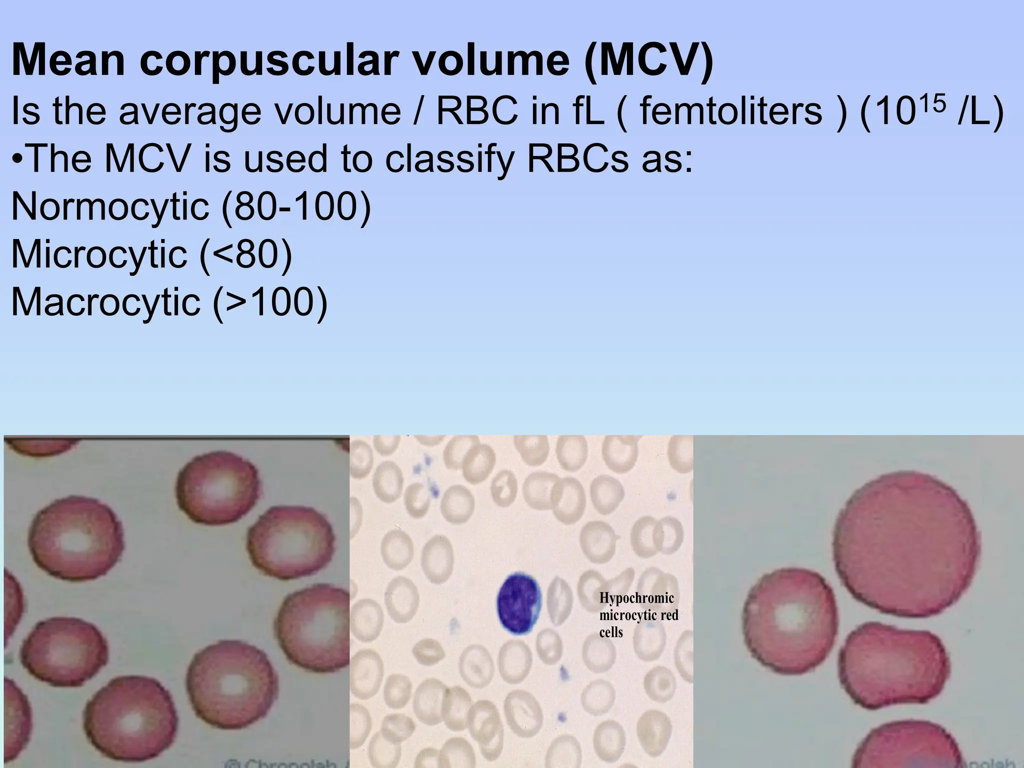 Mean corpuscular volume (MCV)
Is the average volume / RBC in fL ( femtoliters ) (1015 /L)
•The MCV is used to classify RBCs as:
Normocytic (80-100)
Microcytic (<80)
Macrocytic (>100)
Hypochromic
microcytic red
cells
 