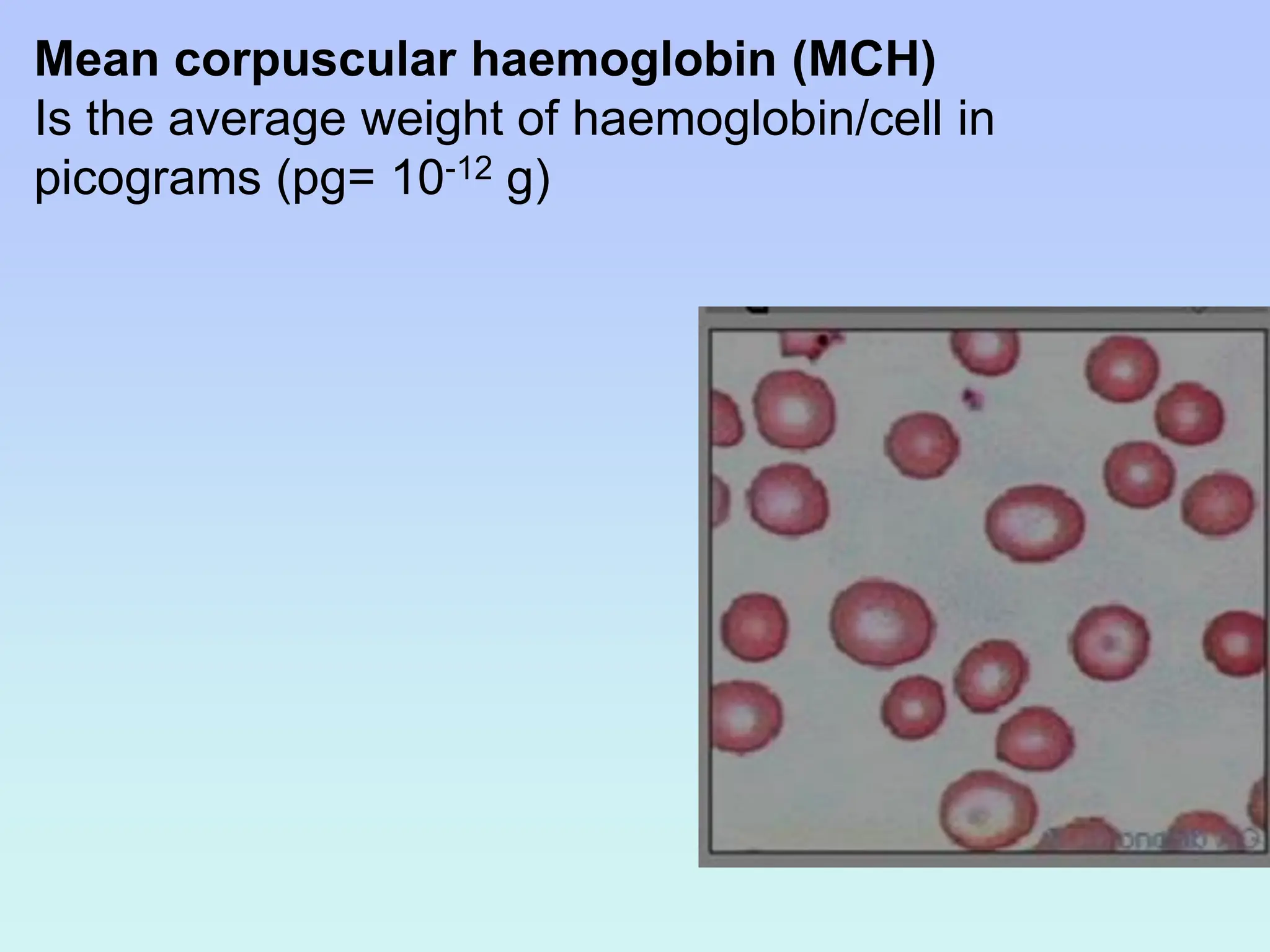 Mean corpuscular haemoglobin (MCH)
Is the average weight of haemoglobin/cell in
picograms (pg= 10-12 g)
 
