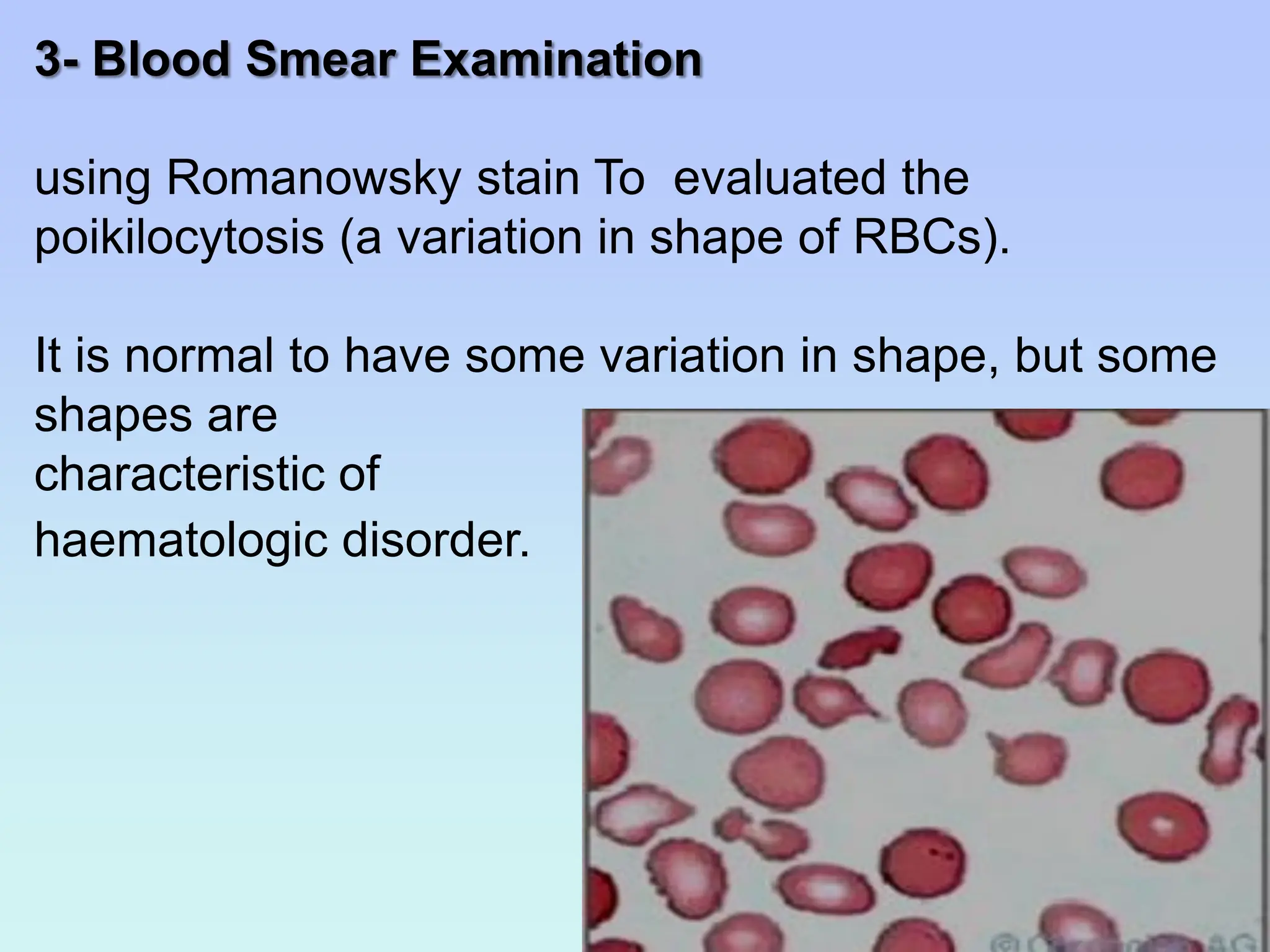 3- Blood Smear Examination
using Romanowsky stain To evaluated the
poikilocytosis (a variation in shape of RBCs).
It is normal to have some variation in shape, but some
shapes are
characteristic of
haematologic disorder.
 