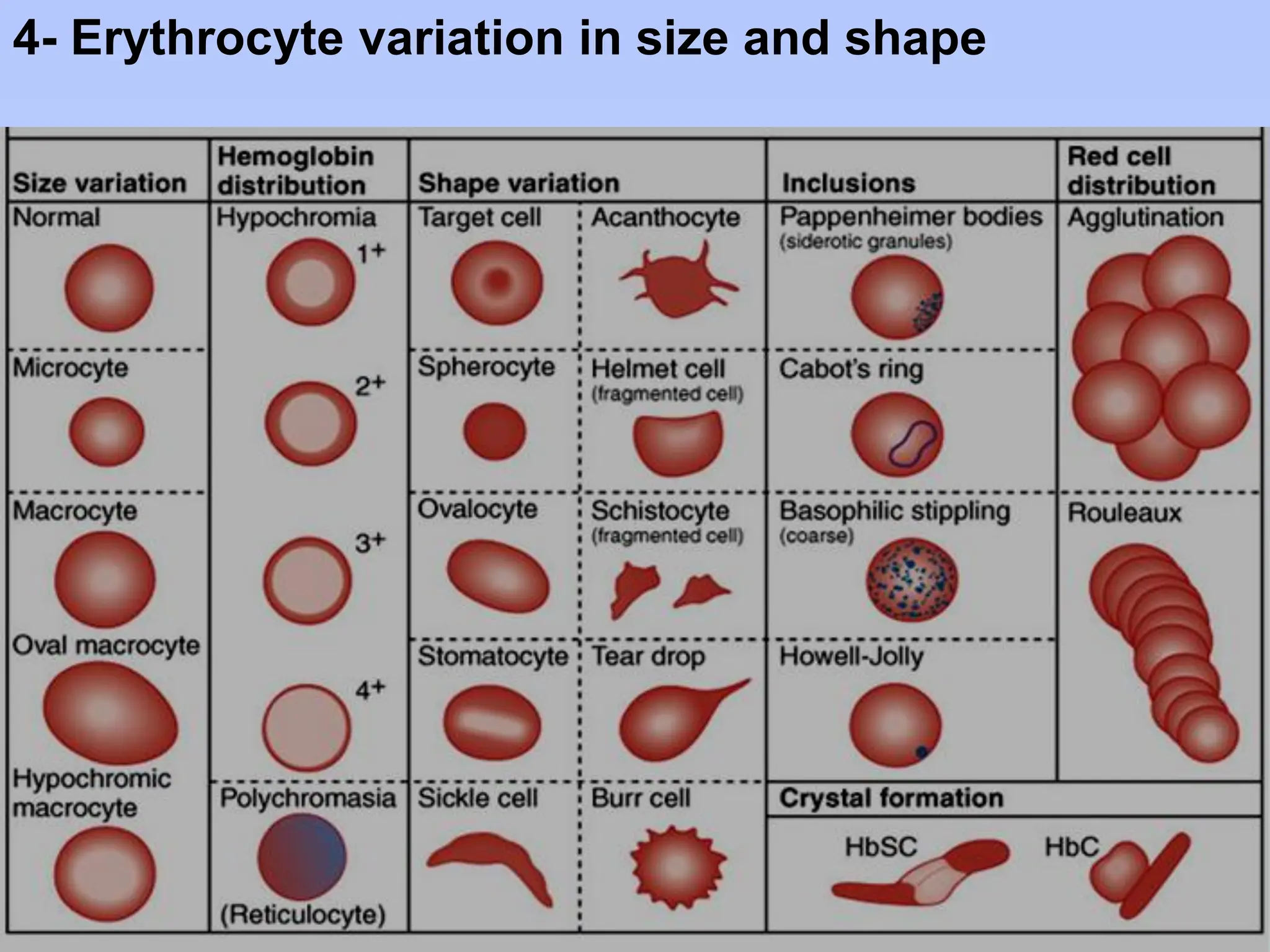 4- Erythrocyte variation in size and shape
 
