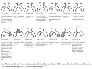 Classification of arterial disease and invstigations | PPTX