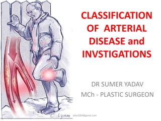 CLASSIFICATION
OF ARTERIAL
DISEASE and
INVSTIGATIONS
DR SUMER YADAV
MCh - PLASTIC SURGEON
sumeryadav2004@gmail.com
 