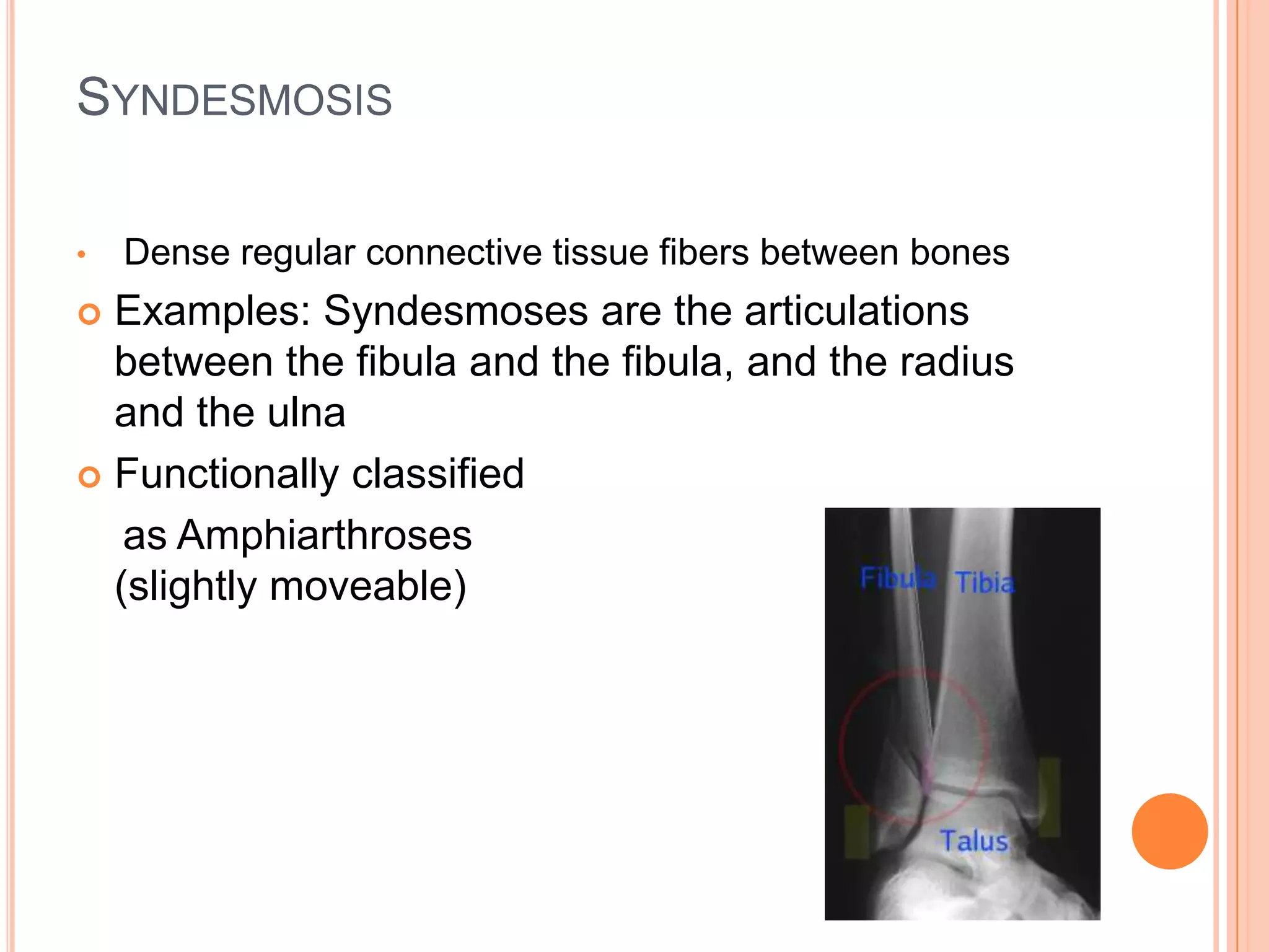 SutureDense regular connective tissue that connects skull bones