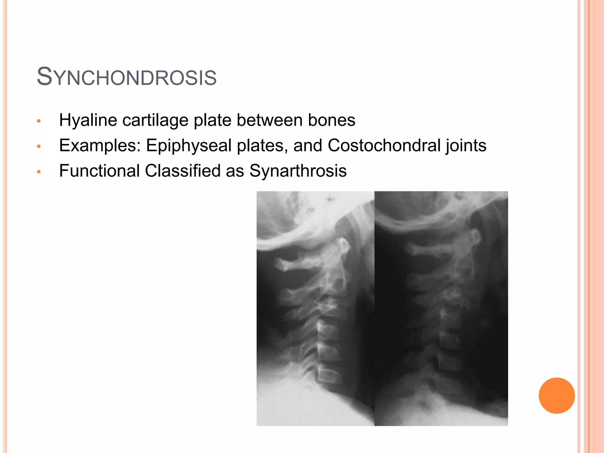 Functionally Classified as SynarthrosisSyndesmosisDense regular connective tissue fibers between bonesExamples: Syndesmosesare the articulations between the fibula and the fibula, and the radius and the ulnaFunctionally classified     as Amphiarthroses(slightly moveable)