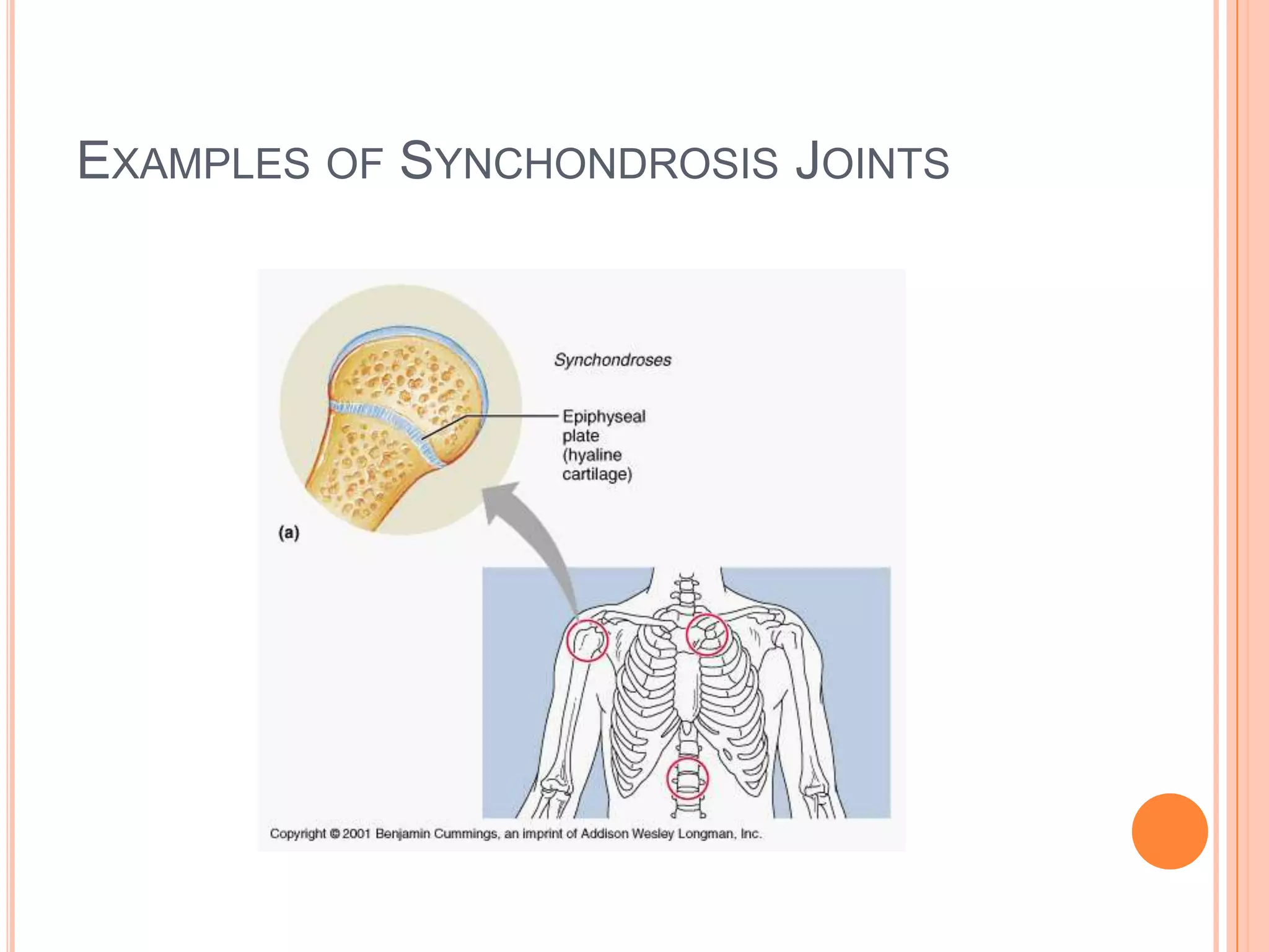 Types of Cartilaginous JointsSynchondrosisSymphysis