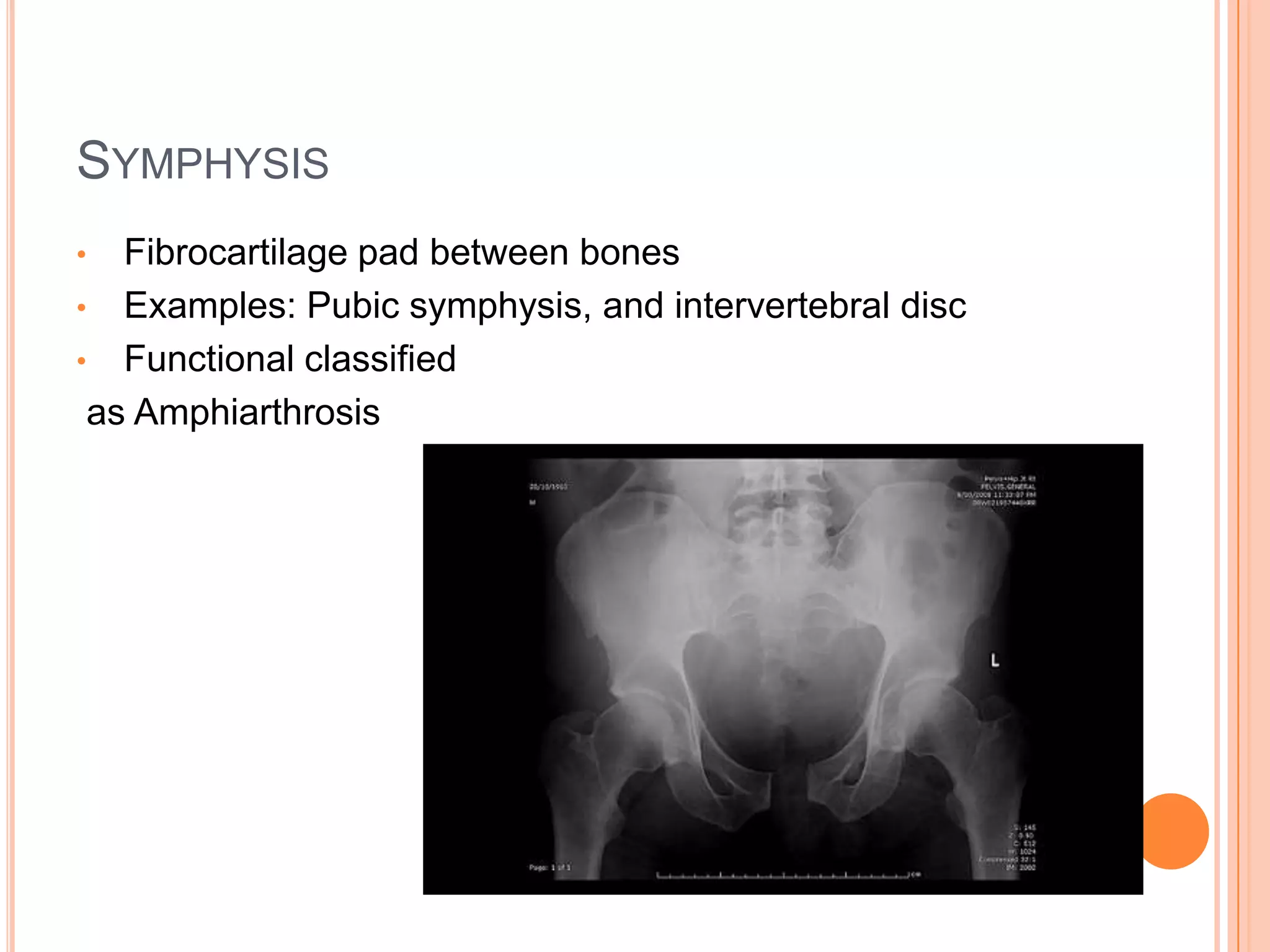 SynchondrosisHyaline cartilage plate between bones