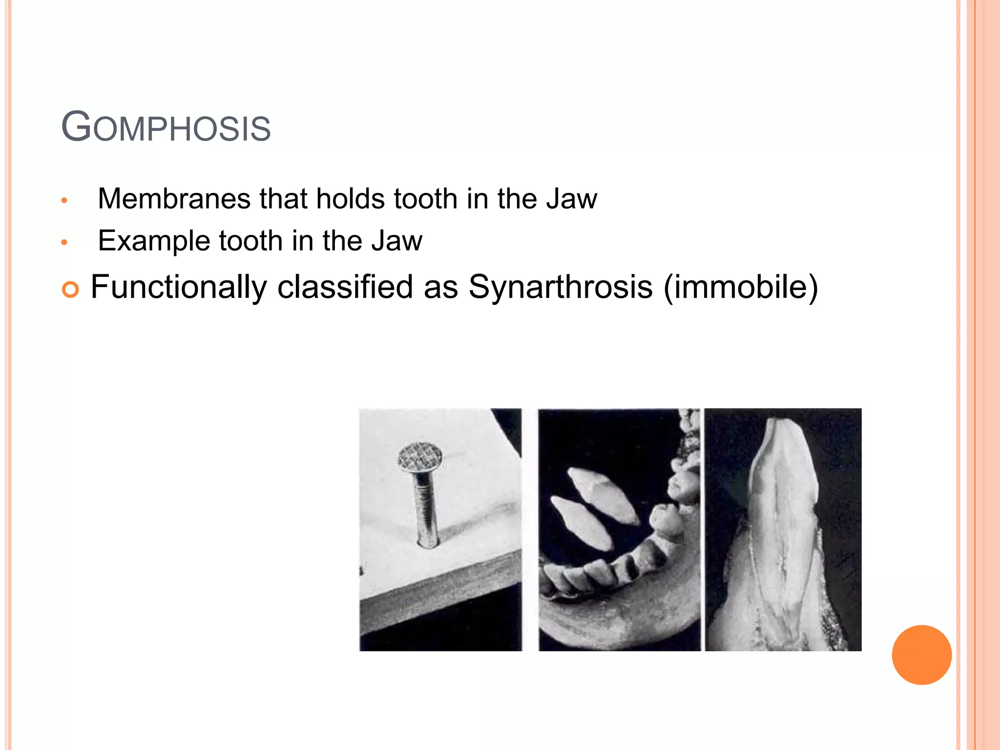 GomphosisMembranes that holds tooth in the Jaw