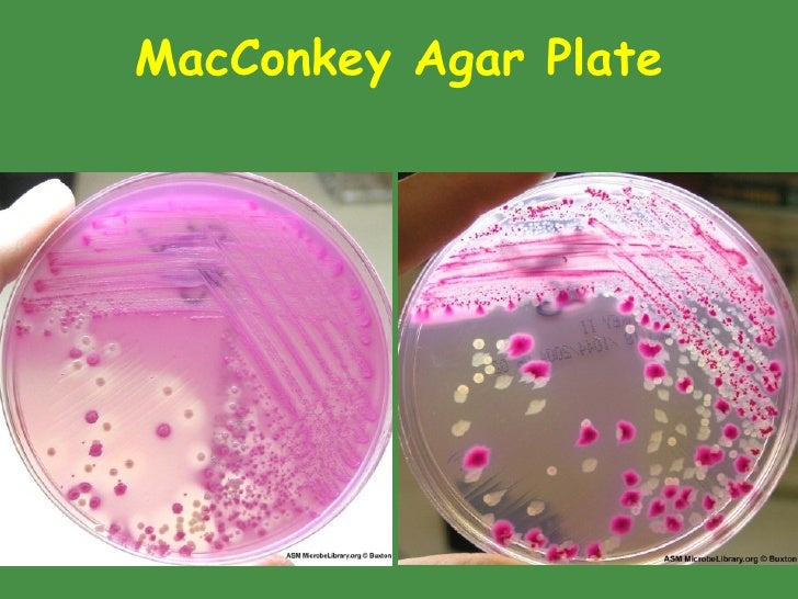 Classificationof Bacteria