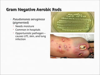 Comprehensive Classification and Clinical Overview of Bacteria | PPT