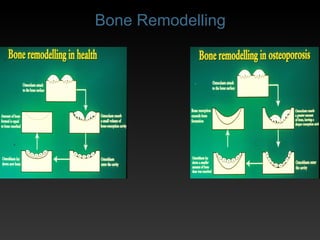 Classification of bones_and_joint_ | PPT