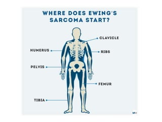 Classification of bone tumors.pptxpbl
