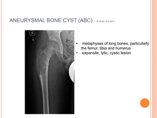 CLASSIFICATION OF BONE TUMORS & PRINCIPLES OF LIMB.pptx