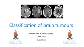 Classification of brain tumours
Department of Neurosurgery
Dr RE Anto
18/03/2022
 