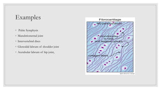 Examples
◦ Pubic Symphysis
◦ Manubriosternal joint
◦ Intervertebral discs
◦ Glenoidal labrum of shoulder joint
◦ Acetabular labrum of hip joint,
 