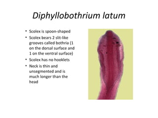 Diphyllobothrium latum
• Scolex is spoon-shaped
• Scolex bears 2 slit-like
grooves called bothria (1
on the dorsal surface and
1 on the ventral surface)
• Scolex has no hooklets
• Neck is thin and
unsegmented and is
much longer than the
head
 