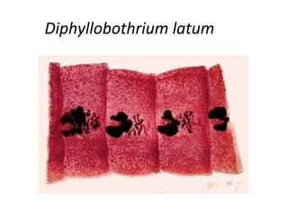 Diphyllobothrium latum
 